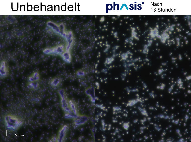 Bild zur illustration des Kalkschutzeffektes eines Phasis P35 gerät